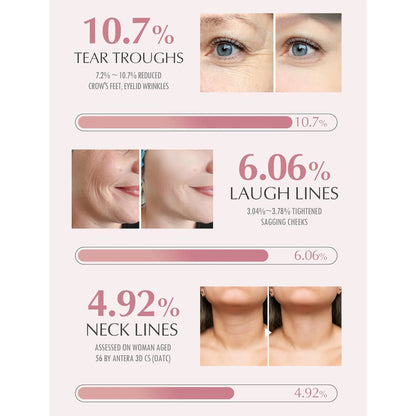 Etchelle Korean Wrinkle Bounce Multi Balm Stick